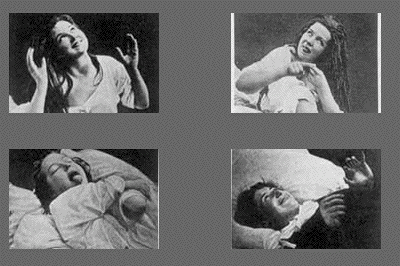 hysterie-salpetriere.gif, nov 2008 hysterie-salpetriere.gif